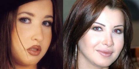 What These Pop Stars Looked Like Before And After Plastic Surgery